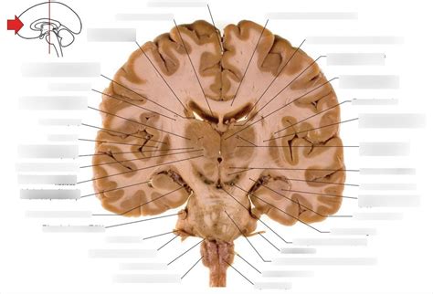 The rostral surface of a coronal section of brain through caudal parts of the ventral lateral ...