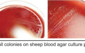 Mycoplasma hominis