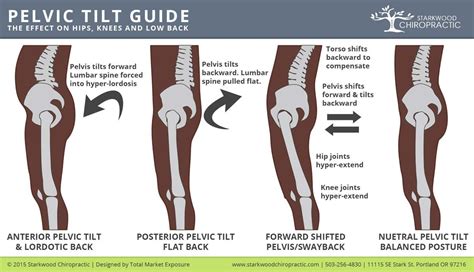 Pelvic-Tilt | Exercise | Pinterest | Tilt, Therapy and Physical therapy