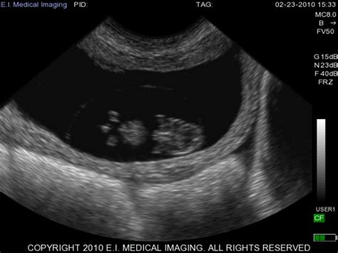 Veterinary Ultrasound | cow ultrasound