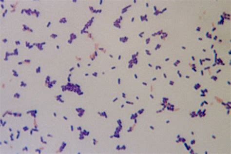 Listeria monocytogenes