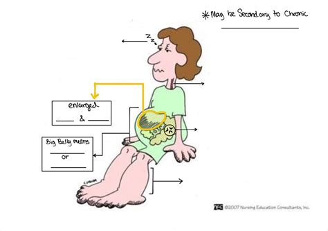 Right sided heart failure Diagram | Quizlet