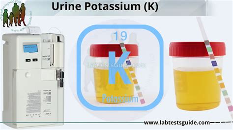 Urine Potassium Understanding: Normal Levels, Causes of High/Low Results, and Treatment Options