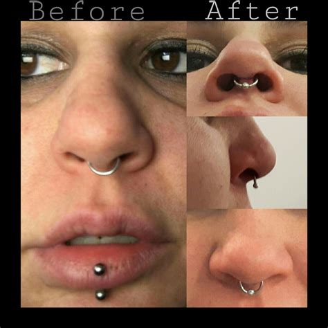 The left side is the crooked placement done elsewhere. The right side is after I pierced her ...