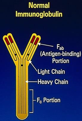 Evaluation of Urine May Aid in the Diagnosis of Lambda Light Chain ...