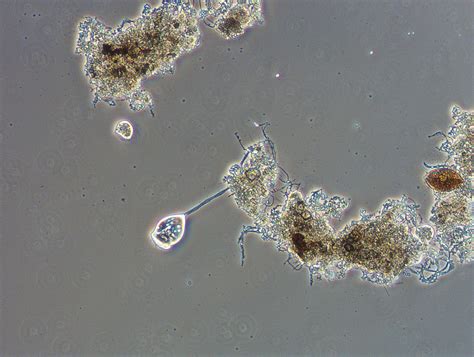 Microscopic Examination of Activated Sludge | Alloway