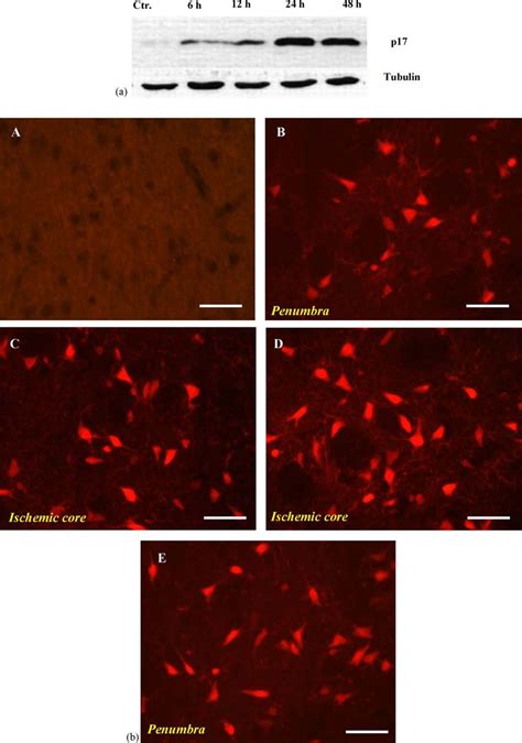 (a) Western blot analysis of the cleaved caspase-3 from samples in the... | Download Scientific ...