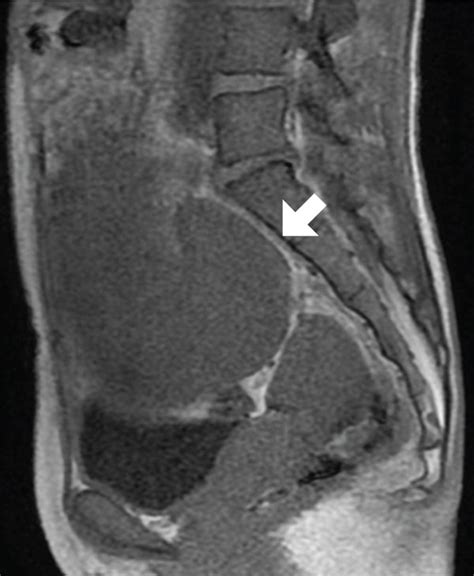 Abdominal MRI Anatomy