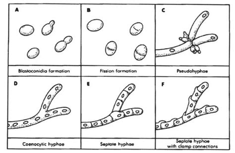 Fungal cell morphology | Medical laboratory science, Microbiology ...