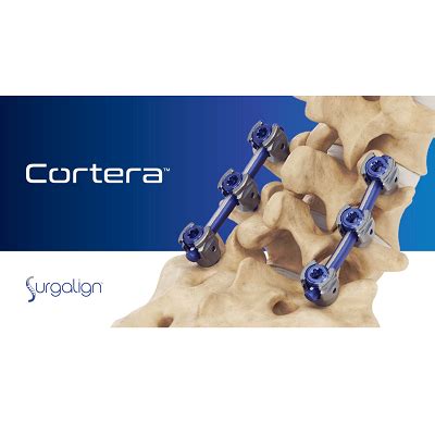 Surgalign Announces FDA 510(k) Clearance of the Cortera™ Spinal Fixation System – The Company’s ...