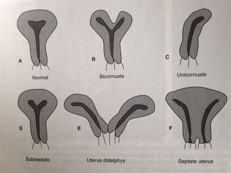 Pin on gynecology