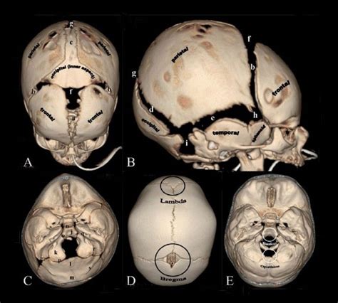 Neonatal skull sutures via UNSW Embryology Wiki | Forensic anthropology, Musculoskeletal system ...