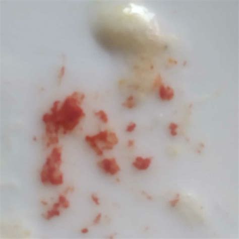 List 91+ Images Pictures Of Blood In Vomit Updated