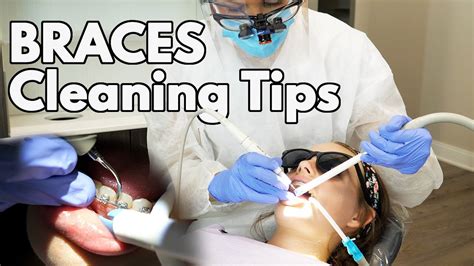 Cleaning Braces (Tips & Tricks for Dental Hygienists) - YouTube