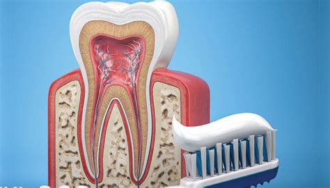 The Delicate Balance of Remineralization and Demineralization - Decisions in Dentistry