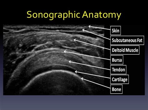 Ultrasound shoulder and knee joints