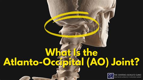 What Is the Atlanto-Occipital (AO) Joint - Centeno-Schultz