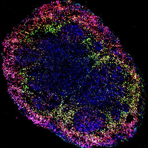 Brain organoids help neuroscientists understand brain development, but ...