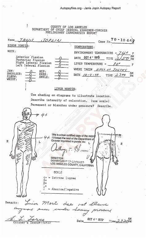 Kurt Cobain Autopsy: Unraveling The Mystery Behind His Tragic Death