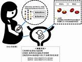 胎児の血液の流れってなんですか？ 胎児循環において新鮮血に静脈血が流入 – BREQ sketch template