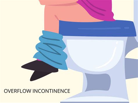 Your Ultimate Guide To Urinary Incontinence In Singapore - Netcom Direct