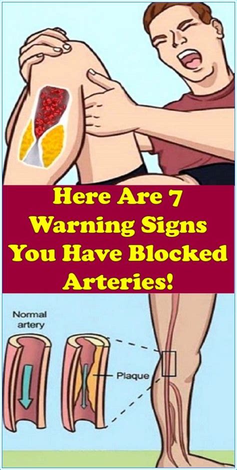 Here Are 7 Warning Signs You Have Blocked Arteries | Warning signs ...