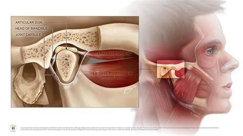 What Is a TMJ Dislocation?