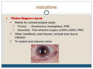 Scleral lenses | PPT