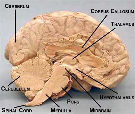 Brain Dissection Labeled