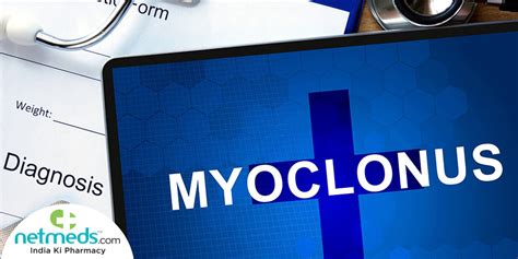 Myoclonus: Causes, Symptoms And Treatment