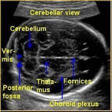 صورة ذات صلة | Radiologi, Kedokteran