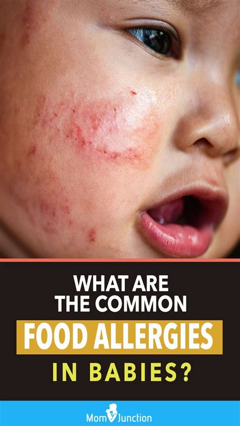 What are the most common food allergies in kids? | Common food ...