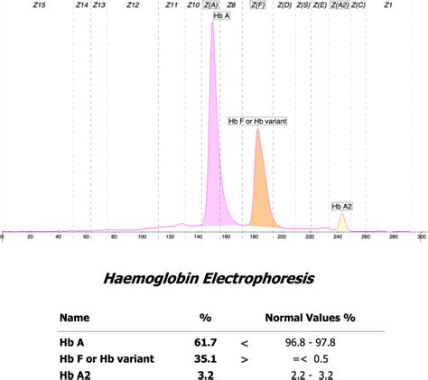 Detection Of Abnormal Hemoglobin Variants By HPLC Method:, 57% OFF