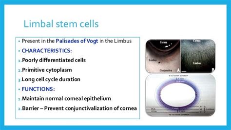 Limbal Stem Cell Deficiency & its management