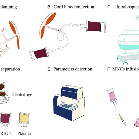 Cord blood processing flow diagram. (A) Cord clamping. (B) Cord blood ...