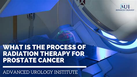 What is the Process of Radiation Therapy for Prostate Cancer | Advanced ...