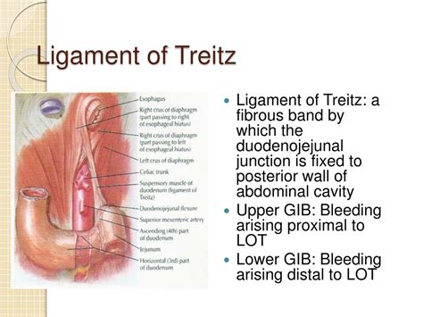 Ligament Of Treitz Upper And Lower Gi - Laney Carmela