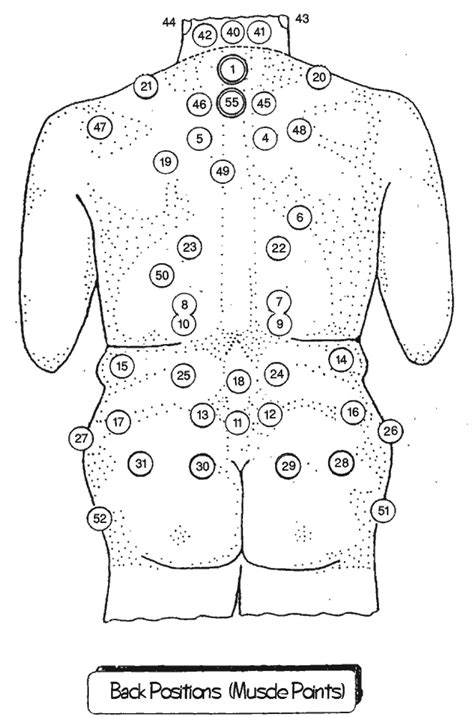 Rickynab Blog: Hijama (Cupping) Treatment Amazing Cure For All Diseases