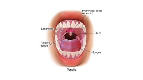 Tonsils - StoryMD