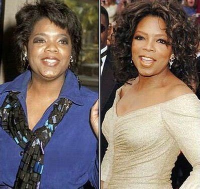 Oprah Winfrey Nose Job Surgery Before And After Photos | 2018 Plastic ...