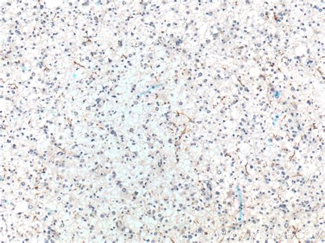 Myelin basic protein Antibody (10458-1-AP)