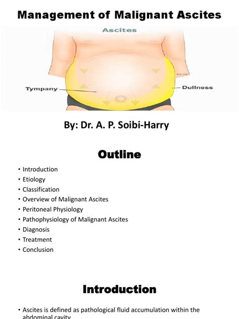 Management of Malignant Ascites | PDF | Ovarian Cancer | Cancer