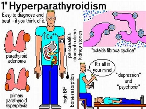 Hyperparathyroidism Nursing Symptoms Pathophysiology Nclex | Hot Sex Picture