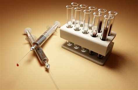 Umbilical Cord Blood Transplant Associated with Lower Risk of Relapse ...