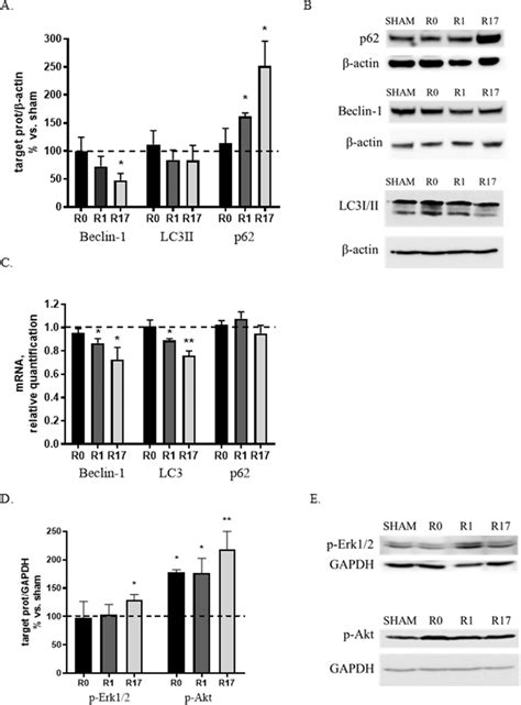 Effects of DCS on protein and gene expression of macroautophagy markers ...