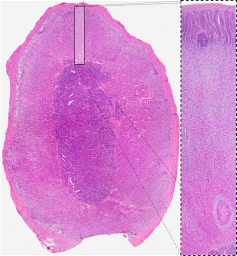 Zona Glomerulosa Histology