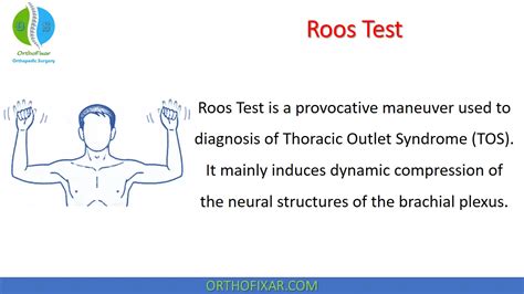 Roos Test | Elevated Arm Stress Test | OrthoFixar 2024