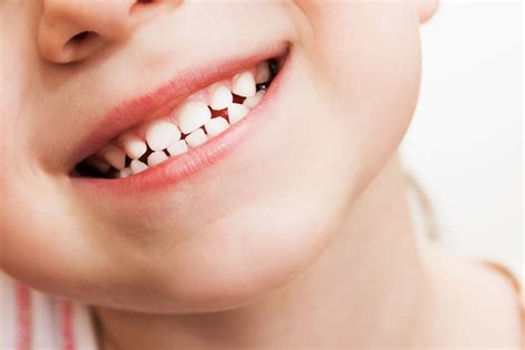 Baby Teeth Coming in Out of Order | Kidtastic Pediatric Dental & Orthodontics | City: Gilbert ...