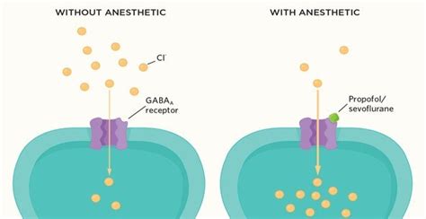 Anesthesia-The Gamechanger | Shutdown of Brain during Anesthesia ...