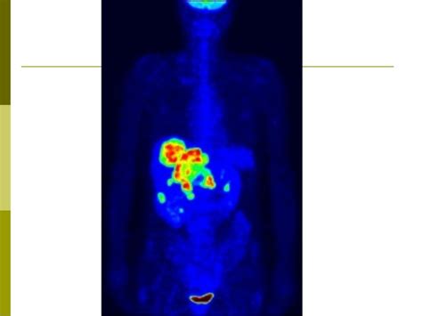 Positron Emission Tomography